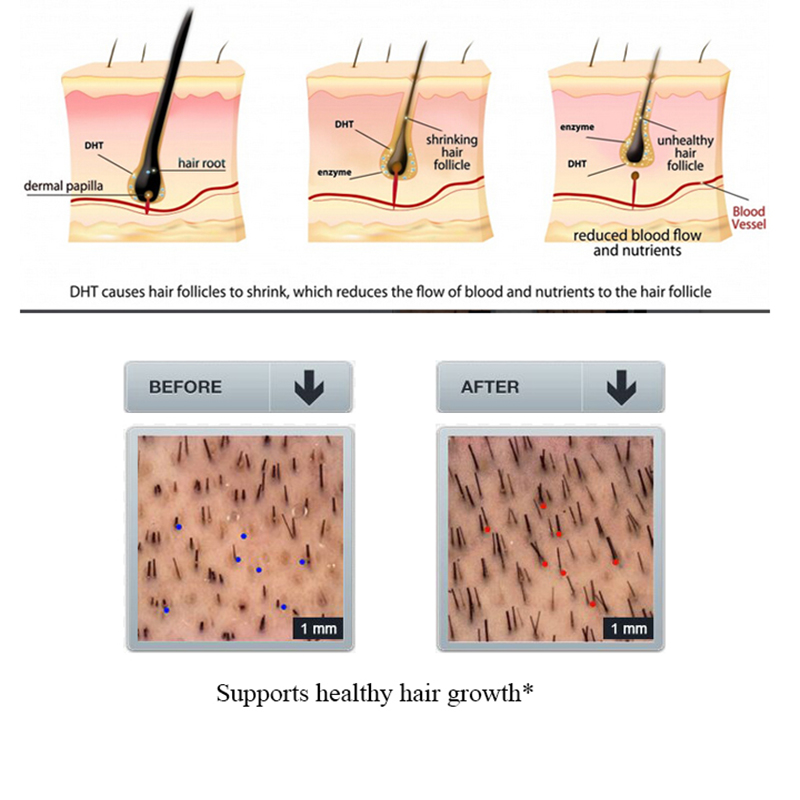 PURC 생강 탈모 샴푸 인삼 모발 성장 치료 재성장  - Licorice Root Sticks 리뷰 및 가격